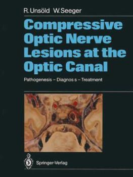 Paperback Compressive Optic Nerve Lesions at the Optic Canal: Pathogenesis - Diagnosis - Treatment Book