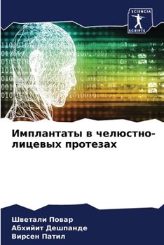 Paperback Имплантаты в челюстно-ли [Russian] Book