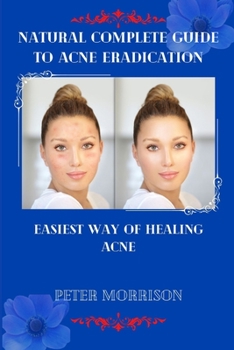 Paperback Natural Complete Guide to Acne Eradication: Easiest Way of Healing Acne Book