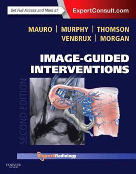 Hardcover Image-Guided Interventions: Expert Radiology Series (Expert Consult - Online and Print) Book
