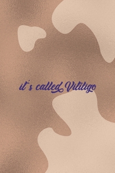 Paperback It's Called Vitiligo: Notebook Journal Composition Blank Lined Diary Notepad 120 Pages Paperback Brown Texture Vitiligo Book