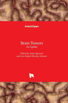 Hardcover Brain Tumors: An Update Book