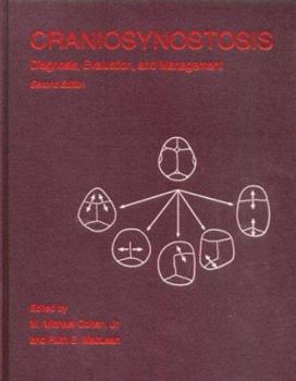 Hardcover Craniosynostosis: Diagnosis, Evaluation, and Management Book