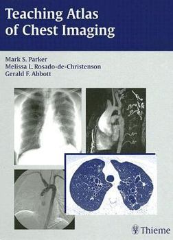 Hardcover Teaching Atlas of Chest Imaging Book