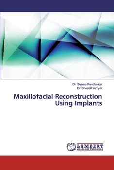 Paperback Maxillofacial Reconstruction Using Implants Book