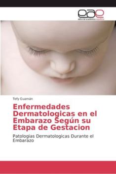 Paperback Enfermedades Dermatologicas en el Embarazo Según su Etapa de Gestacion [Spanish] Book