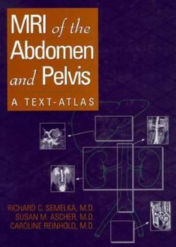 Hardcover MRI of the Abdomen and Pelvis Book