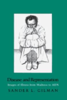 Paperback Disease and Representation Book