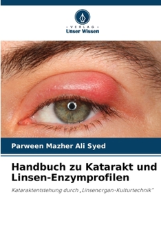 Paperback Handbuch zu Katarakt und Linsen-Enzymprofilen [German] Book