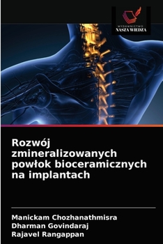 Paperback Rozwój zmineralizowanych powlok bioceramicznych na implantach [Polish] Book