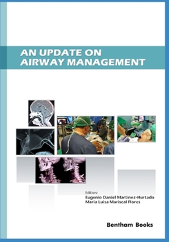 Paperback An Update on Airway Management Book