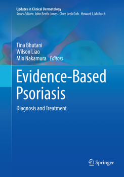 Paperback Evidence-Based Psoriasis: Diagnosis and Treatment Book