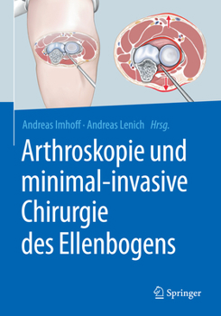Hardcover Arthroskopie Und Minimal-Invasive Chirurgie Des Ellenbogens [German] Book