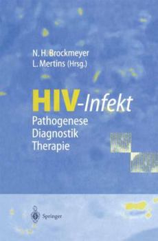 Paperback Hiv-Infekt: Pathogenese - Diagnostik - Therapie [German] Book