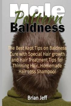 Paperback Male Pattern Baldness: The Best Kept Tips On Baldness Cure With Special Hair Growth and Hair Treatment Tips for Thinning Hair ...Homemade Hai Book