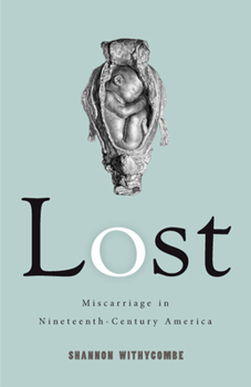 Paperback Lost: Miscarriage in Nineteenth-Century America Book
