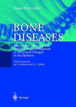 Hardcover Bone Diseases: Macroscopic, Histological, and Radiological Diagnosis of Structural Changes in the Skeleton Book