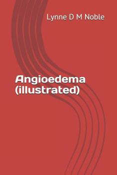 Paperback Angioedema (illustrated) Book