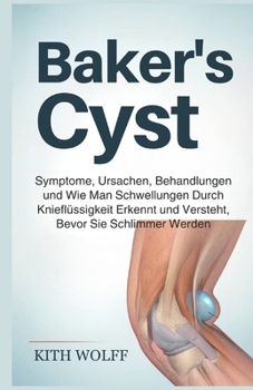 Baker’s Cyst: Symptome, Ursachen, Behandlungen und wie man Schwellungen durch Knieflüssigkeit erkennt und versteht, bevor sie schlimmer werden (German Edition)