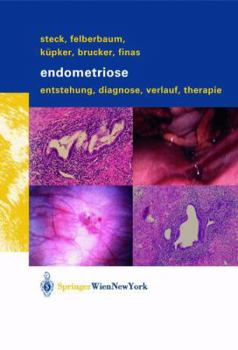 Paperback Endometriose: Entstehung, Diagnose, Verlauf Und Therapie [German] Book