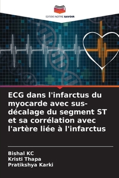 ECG dans l'infarctus du myocarde avec sus-décalage du segment ST et sa corrélation avec l'artère liée à l'infarctus (French Edition)