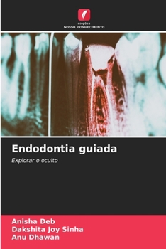 Endodontia guiada (Portuguese Edition)