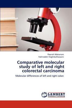 Paperback Comparative molecular study of left and right colorectal carcinoma Book