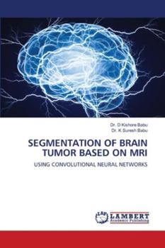 Paperback Segmentation of Brain Tumor Based on MRI Book