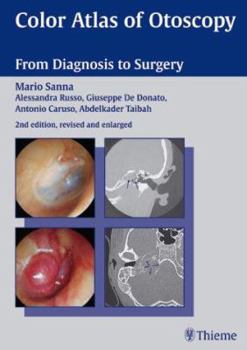 Paperback Color Atlas of Otoscopy: From Diagnosis to Surgery Book