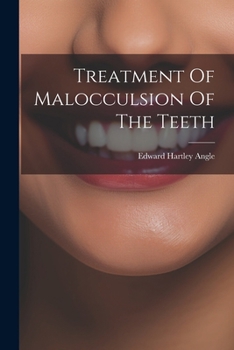 Paperback Treatment Of Malocculsion Of The Teeth Book