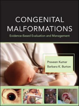 Hardcover Congenital Malformations: Evidence-Based Evaluation and Management Book