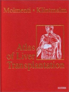 Hardcover Atlas of Liver Transplantation Book