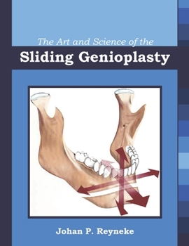 Paperback The Art and Science of the Sliding Genioplasty Book