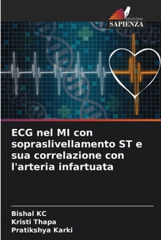 ECG nel MI con sopraslivellamento ST e sua correlazione con l'arteria infartuata (Italian Edition)