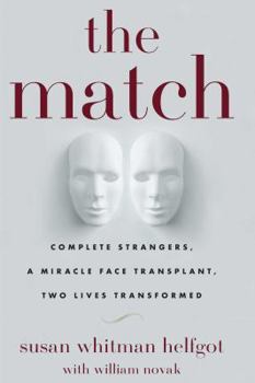 Paperback The Match: Complete Strangers, a Miracle Face Transplant, Two Lives Transformed Book