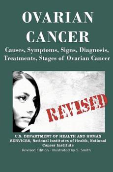 Paperback Ovarian Cancer: Causes, Symptoms, Signs, Diagnosis, Treatments, Stages of Ovarian Cancer Book