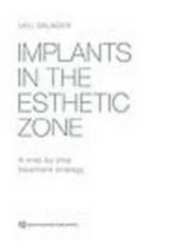 Hardcover Implants in the Esthetic Zone: A Step-by-Step Treatment Strategy Book