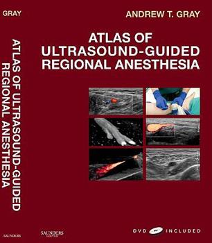 Hardcover Atlas of Ultrasound-Guided Regional Anesthesia: Expert Consult - Online and Print Book