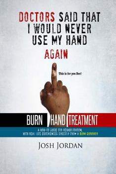 Paperback Burn Hand Treatment: A How-To Guide for Rehabilitation with Real Life Experiences from a Burn Survivor Book
