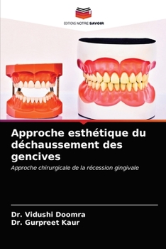 Paperback Approche esthétique du déchaussement des gencives [French] Book