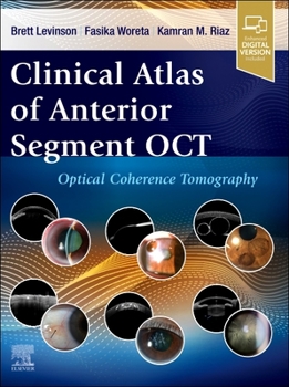 Hardcover Clinical Atlas of Anterior Segment Oct: Optical Coherence Tomography Book