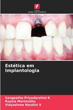 Paperback Estética em Implantologia [Portuguese] Book