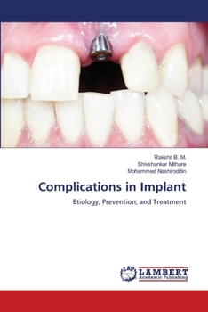 Paperback Complications in Implant Book