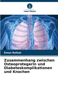 Paperback Zusammenhang zwischen Osteoprotegerin und Diabeteskomplikationen und Knochen (German Edition) [German] Book