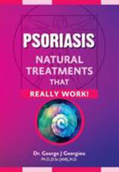 Paperback Psoriasis: Natural Treatments That Really Work! Book