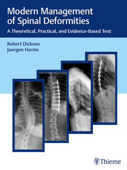 Hardcover Modern Management of Spinal Deformities: A Theoretical, Practical, and Evidence-Based Text Book