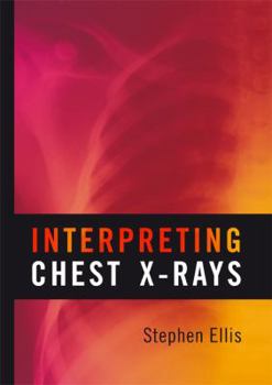 Paperback Interpreting Chest X-Rays Book