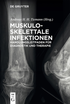 Paperback Muskuloskelettale Infektionen [German] Book