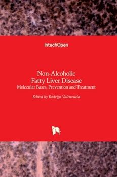 Hardcover Non-Alcoholic Fatty Liver Disease: Molecular Bases, Prevention and Treatment Book
