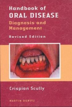 Paperback Handbook of Oral Disease: Diagnosis and Management Book